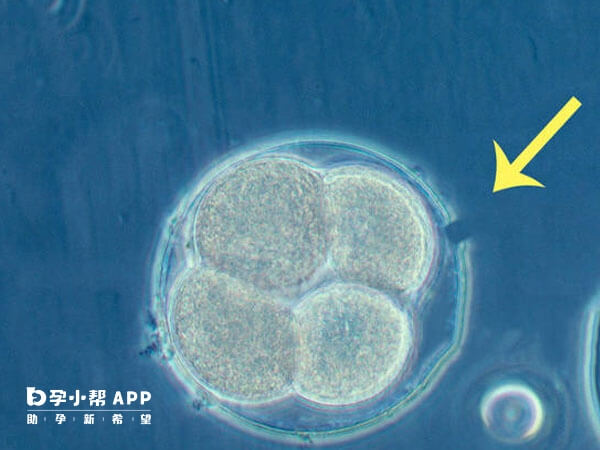 激光辅助技术可以帮助胚胎从透明带孵出