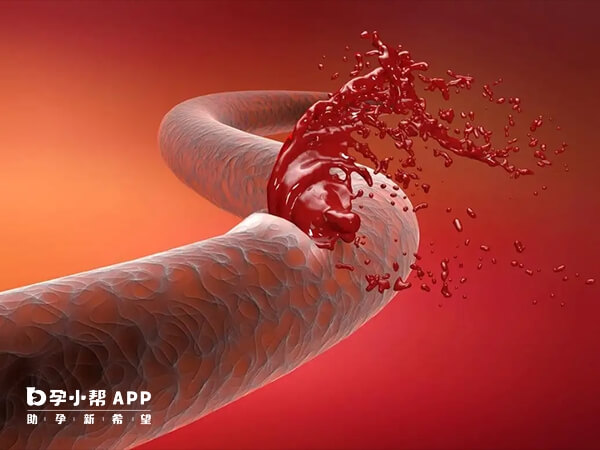 血栓弹力图显示低凝状态容易产生血栓
