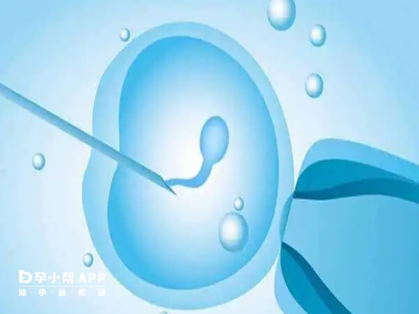 精子DNA碎片率高会增加怀孕流产率