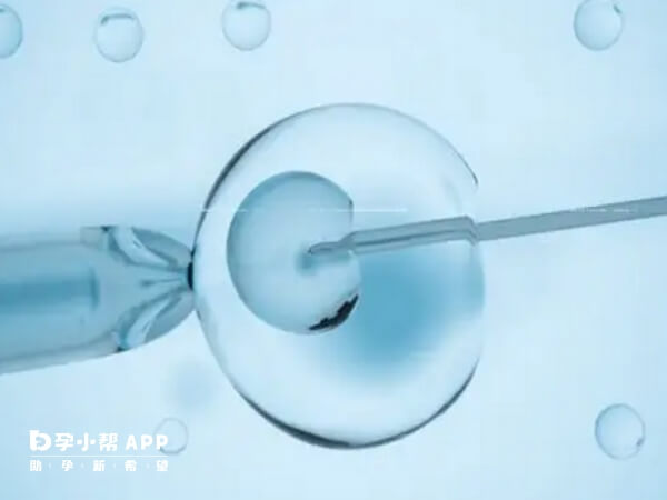 试管技术不能选择胚胎性别