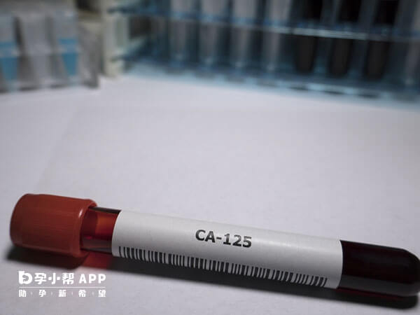 ca125是一种常见的癌症标记物