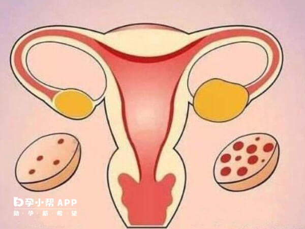 子宫病理性萎缩不能维持胚胎生长发育
