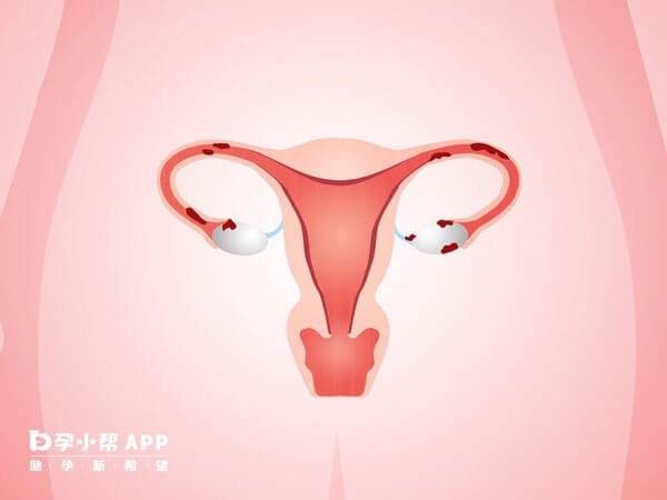 短方案适合卵巢功能不好的不孕患者