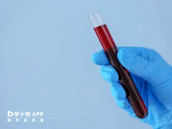 熊猫血不管生育几胎都有溶血的风险