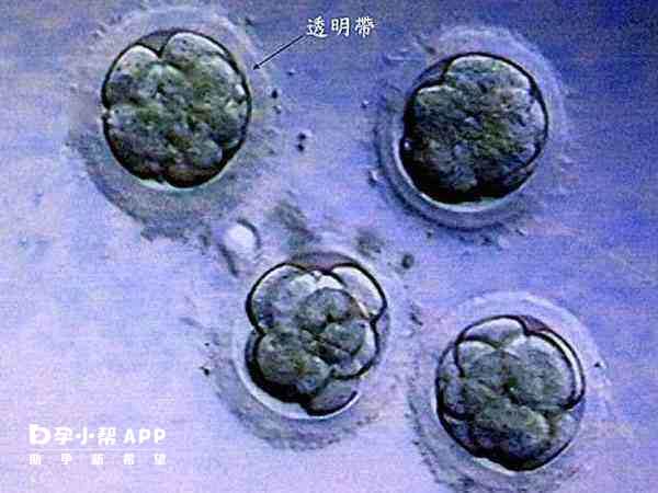 囊胚冷冻前辅助孵化可以增加解冻后的存活率