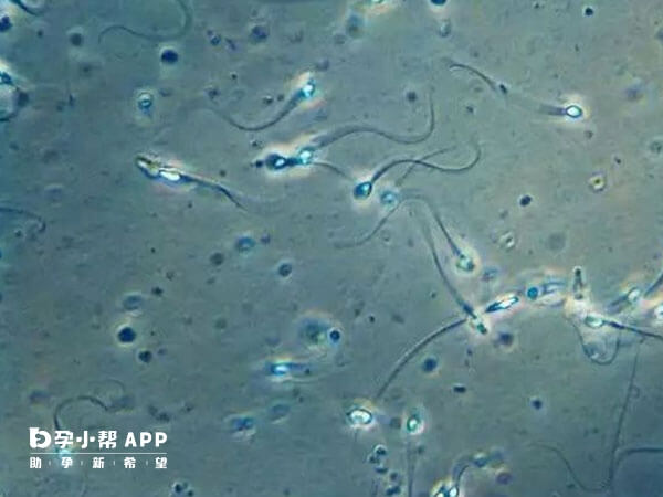 精子白细胞数量多可能是身体存在炎症