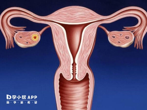 子宫宫腔发育异常需要先进行治疗
