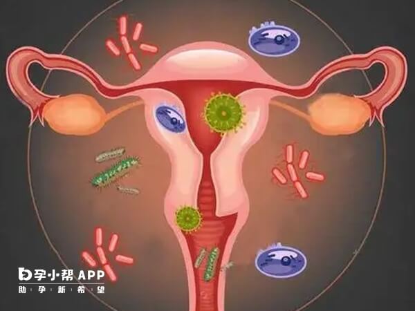 阴道炎可能会上行感染引起妇科疾病