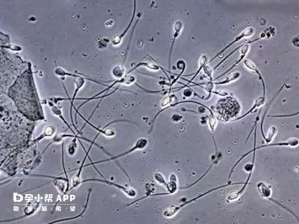 精子白细胞多需要进行消炎治疗