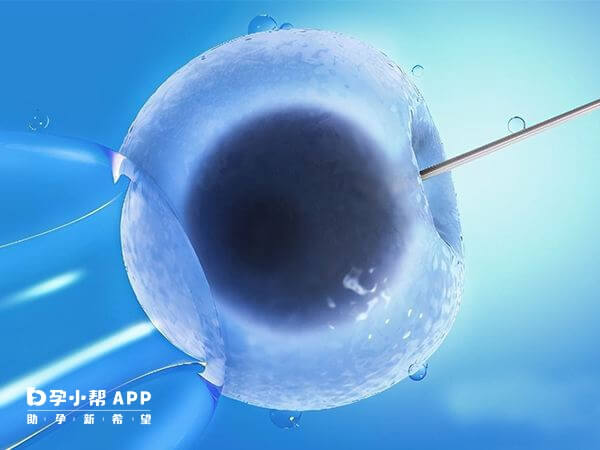 多囊卵巢患者适合用替代周期移植冻胚