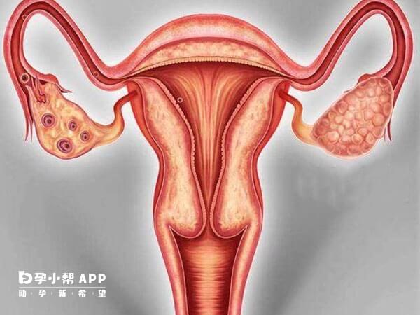 卵巢大可通过药物和手术进行治疗