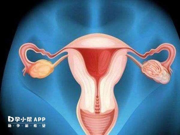 输卵管结扎也可以预防异位妊娠