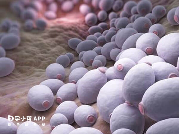 白色念珠菌会引起霉菌性阴道炎