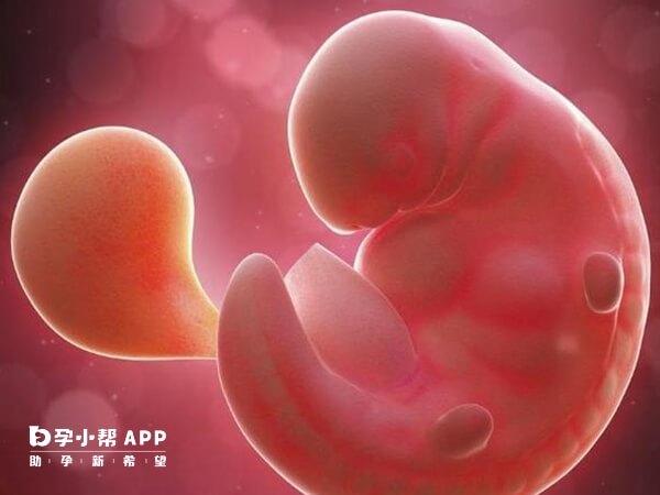 空孕囊是胚胎停育的一种形式