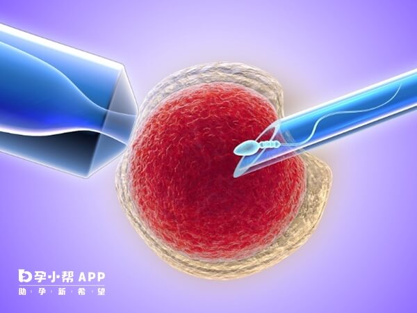 二代试管就是单精子注射受精