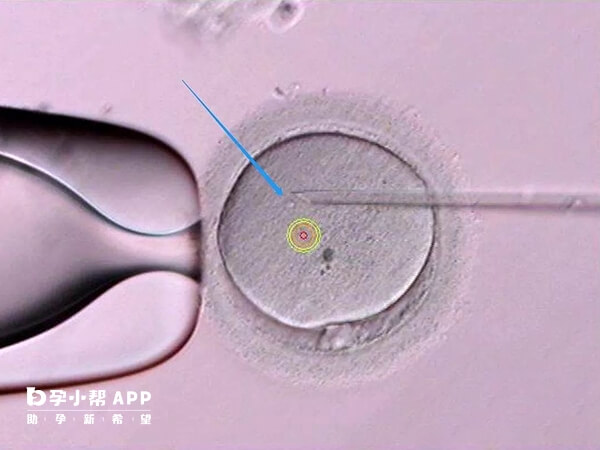 卵母细胞老化会导致养囊失败