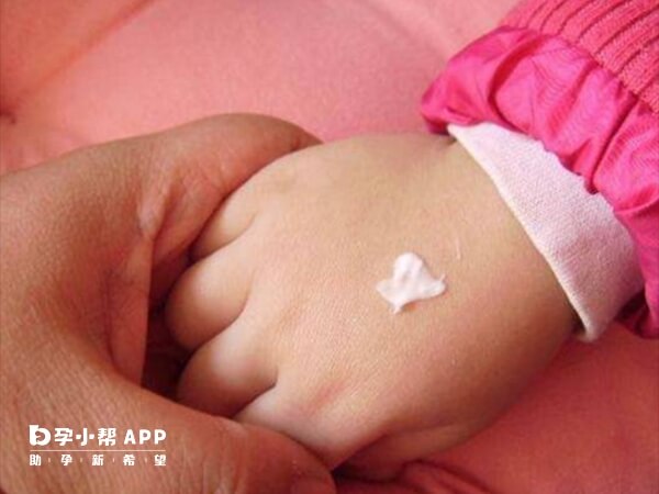 3个月的婴儿要注意预防湿疹