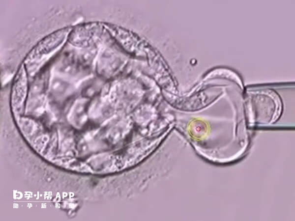 囊胚活检是取滋养层细胞