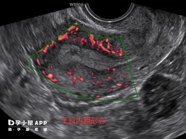 内膜过薄过后都可能与病变有关