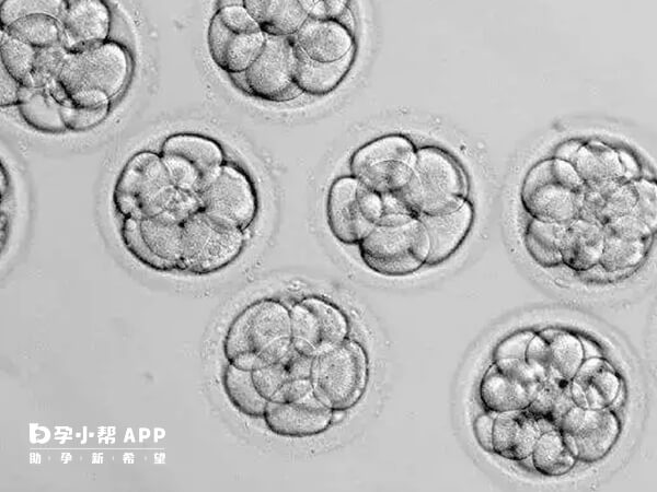 胚胎唐氏综合征是染色体异常