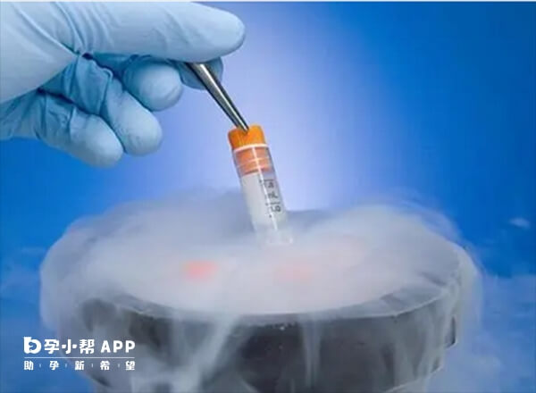冻胚移植手术一般不需要住院