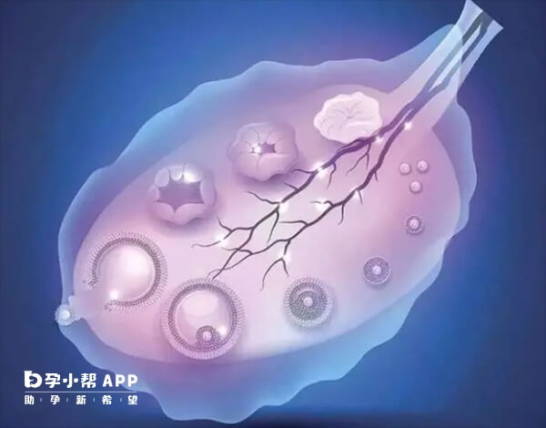卵巢增大严重时可能会出现休克