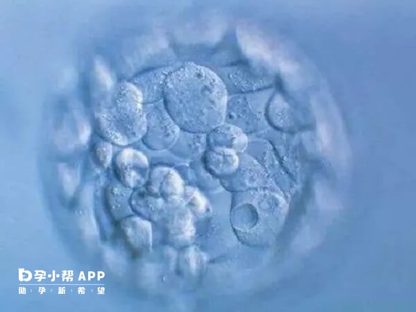 胚胎碎片多与精卵质量有关