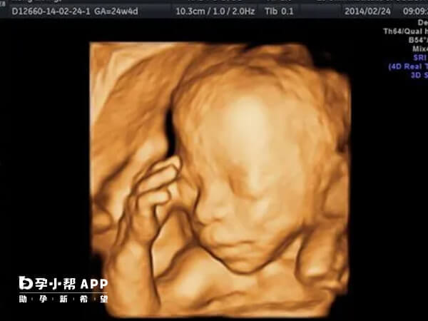 四维彩超图像上胎儿面相下巴尖的大概率是男孩