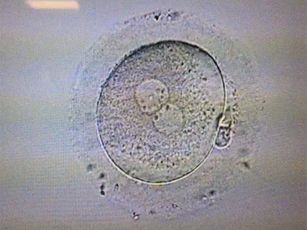 胚胎透明带过厚的原因分析：不全是基因突变引起
