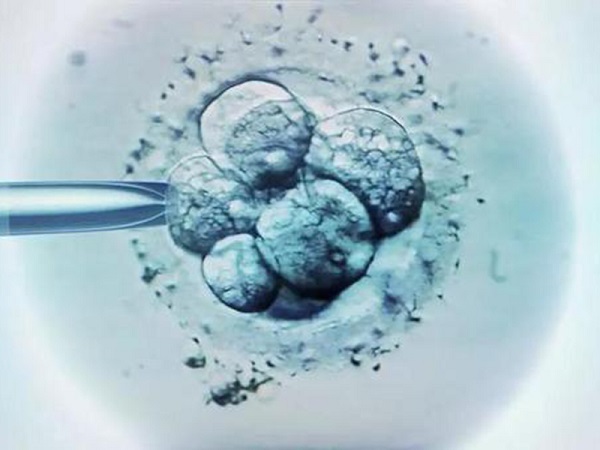 d4胚胎是什么意思？附质量等级与移植成功率分析