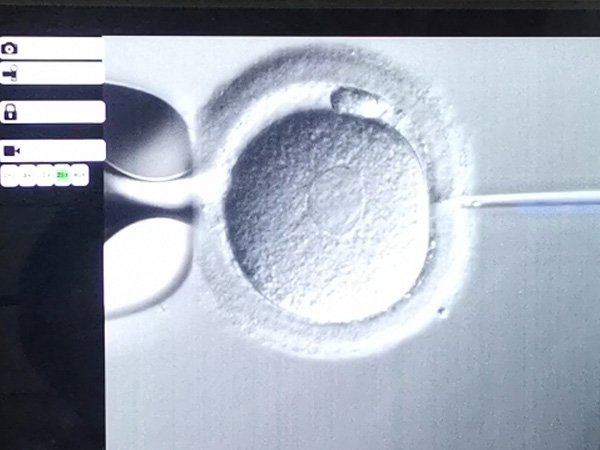 胚胎ser是什么意思？可以移植吗？