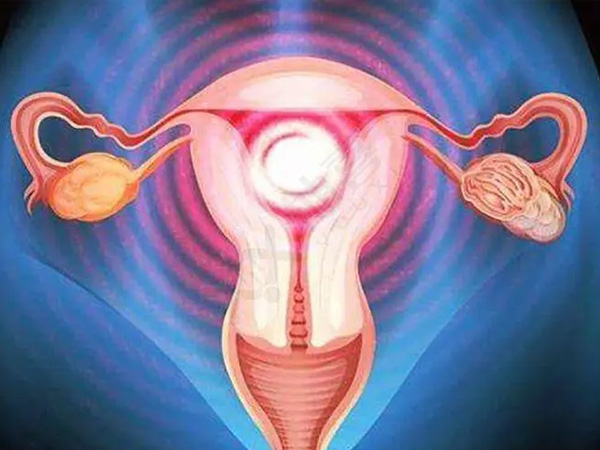 轻微弓形子宫做试管婴儿可以移植两个胚胎要双胞胎吗？