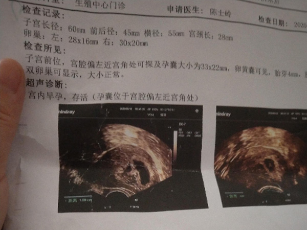 第一次囊胚移植长左宫角了，右侧睡胚胎还能回到宫内吗？