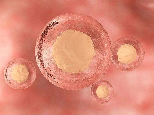 四级胚胎质量差移植成功孩子健康吗？
