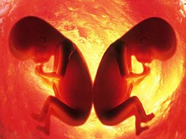 个子矮小的人试管适合放两个胚胎怀双胞胎吗？
