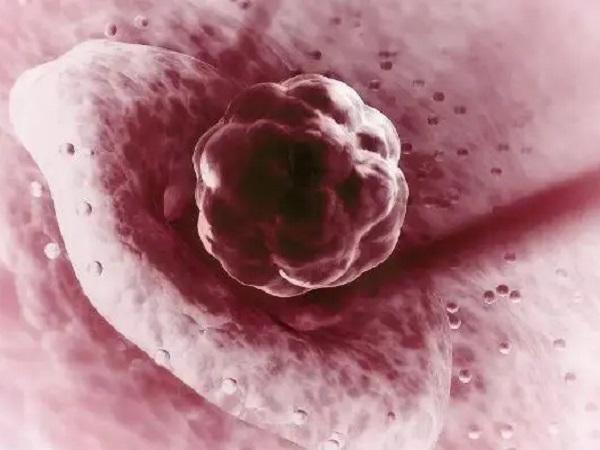 有2个0pn无原核的囊胚到底移不移植？生出的孩子会畸形吗？