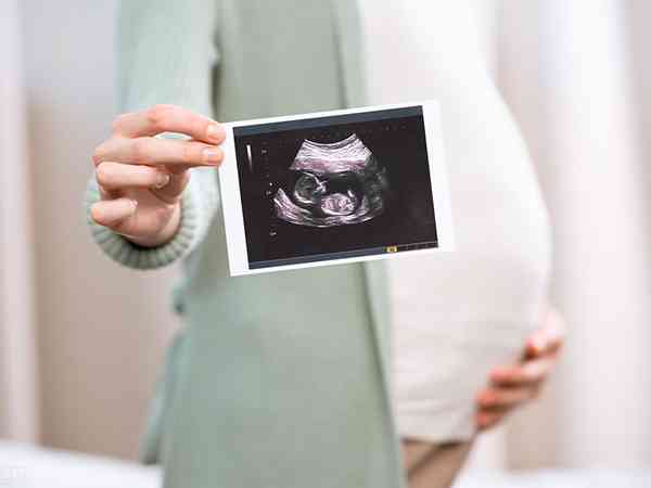 孕32周必须要做小排畸三维彩超检查吗？
