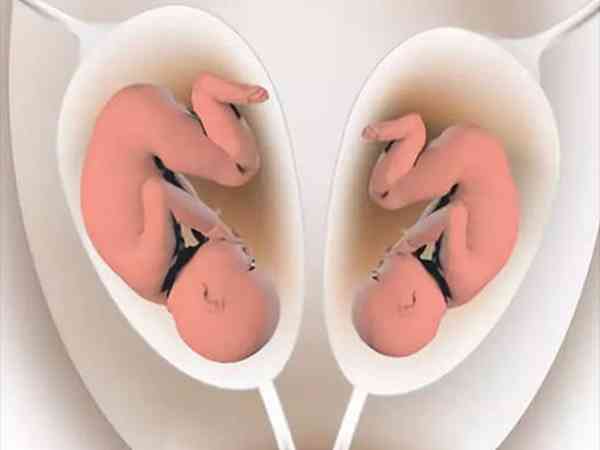 同卵和异卵双胞胎可以通过长相区别开来吗？