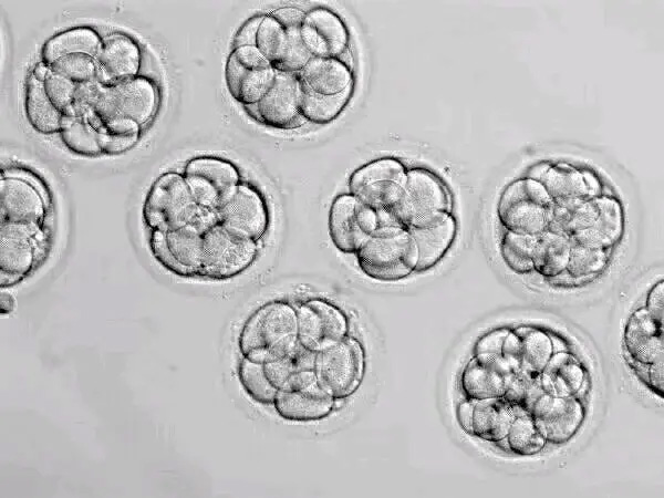 胚胎移植前都要做植入前遗传学诊断PGD吗？
