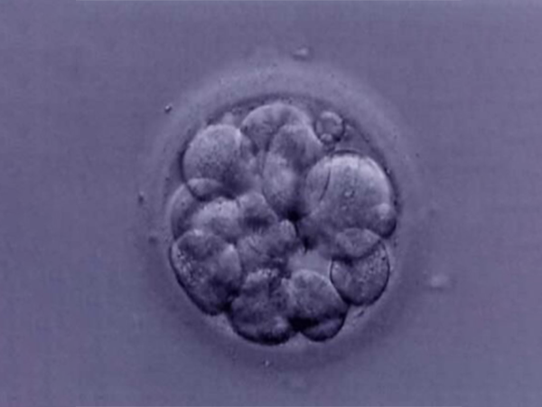 26岁女性移植囊胚一般移植几个？