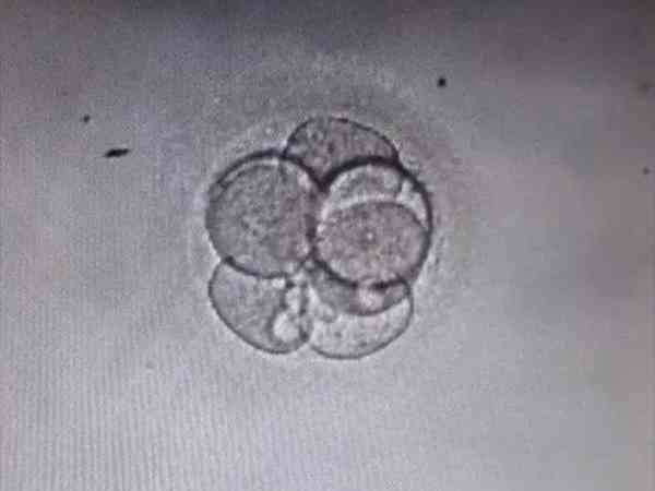 一级胚胎不着床的原因是母体排斥吗？