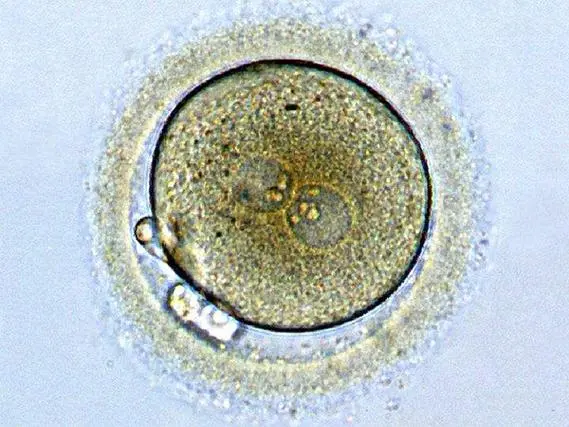 胚胎培养和养囊有没有区别？是不是一个概念？