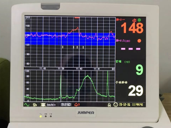 试管婴儿着床后没胎心正常吗？什么原因造成？