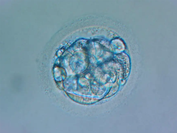 子宫内膜过厚影响胚胎质量，会导致着床失败吗？