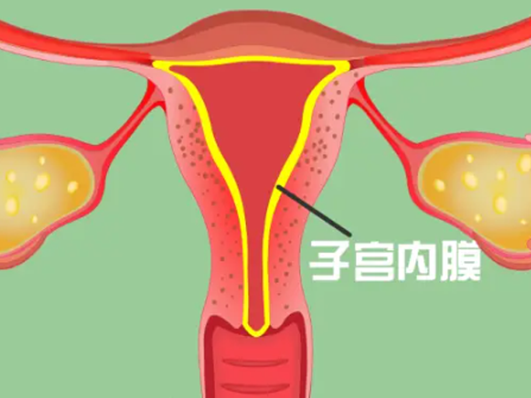 取卵后子宫内膜薄吃哪些含雌激素的食物能增厚？