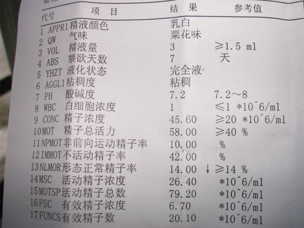 取精前男性精液检查除了精子活力还有其他什么数值？