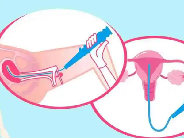 宫腔灌注薄化子宫内膜会不会有刺痛感或出血？