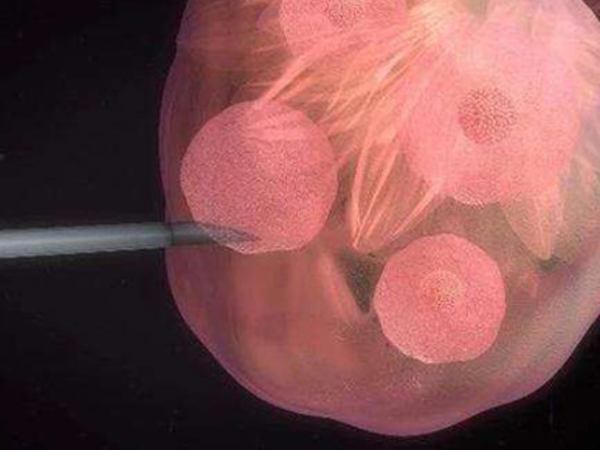 囊胚移植失败怎样计算下次胚胎移植周期？