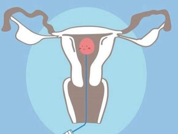 预防胚胎移植反复失败要做染色体和子宫检查吗？