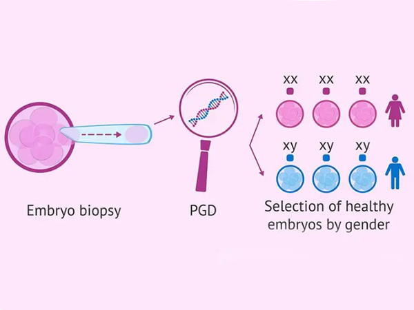 试管婴儿筛选健康胚胎的方法除了PGD还有什么？